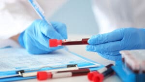 In London, the cost of blood tests can vary a lot. This is because prices change based on where you go and how fast you need the results. This guide aims to explain the cost of private blood tests in London clearly. This way, you can understand the value, not just the price.